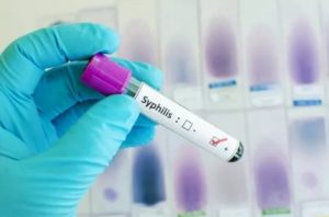 Read more about the article Mansa district records rise in Syphilis cases
