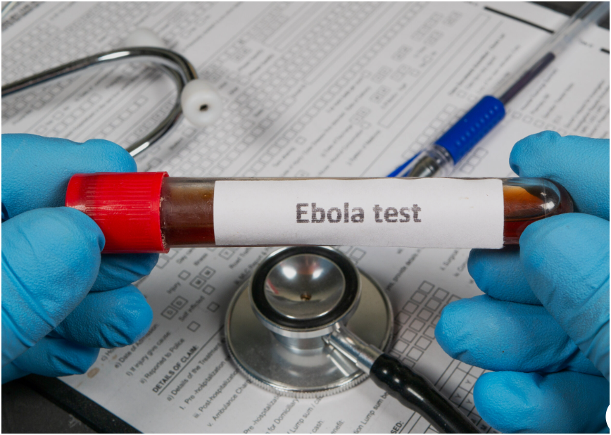 You are currently viewing MOH IN NAKONDE INTENSIFIES EBOLA SURVEILLANCE